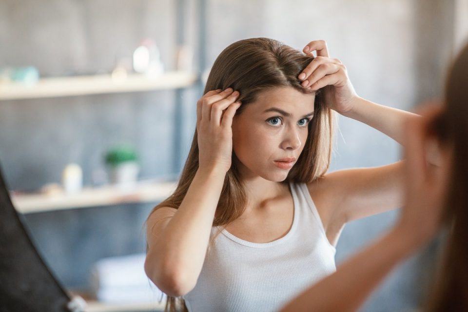 How Hair Loss Affects Self-Esteem